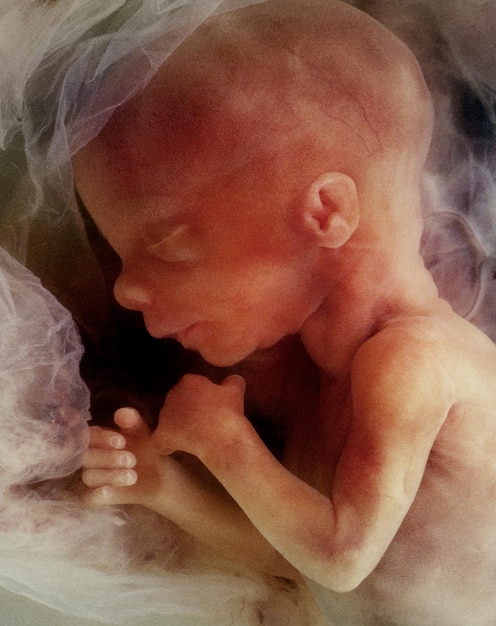 Photo invitro image of a human fetus