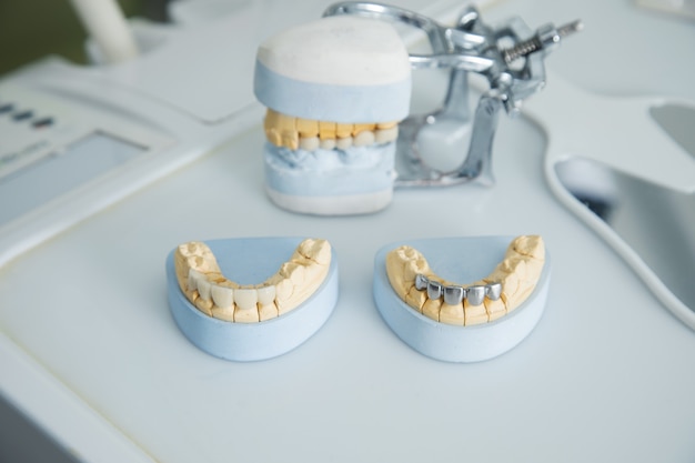 Jaw mock-up on the dentist's table