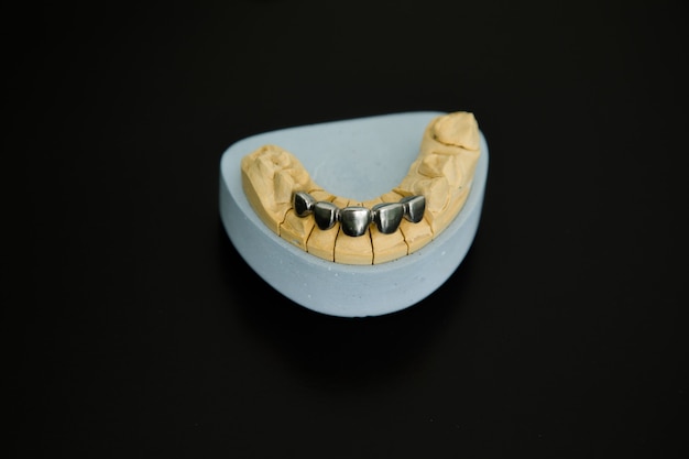 Jaw mock-up on the dentist's table