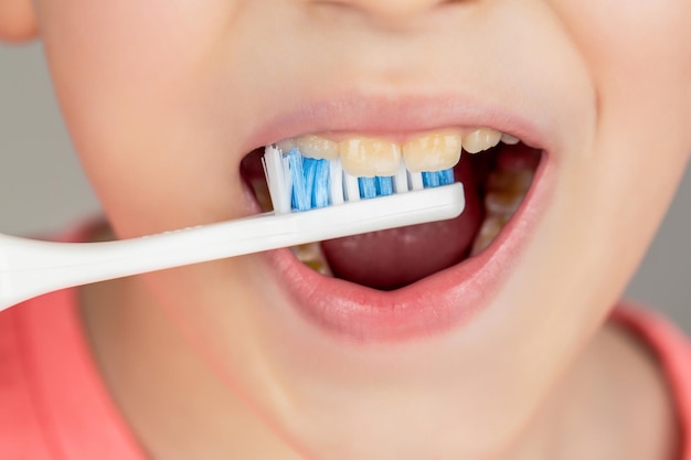 Joyful child shows toothbrushes Little boy cleaning teeth Dental hygiene Happy little kid brushing her teeth Kid boy brushing teeth Boy toothbrush white toothpaste Health care dental hygiene