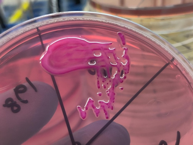 Klebsiella pneumoniae or Klebsiella spp bacteria culture growth on MacConkey agar contains small