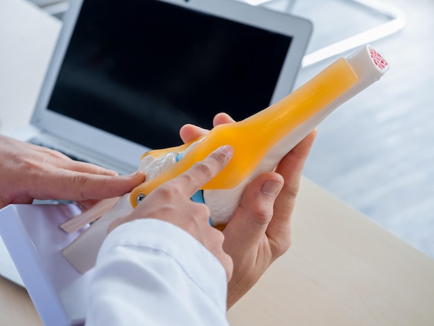 The knee ligaments model holding and pointing by doctor's hands counseling by adult male specialist to young female doctor near laptop Two doctors talking and working together in medical office