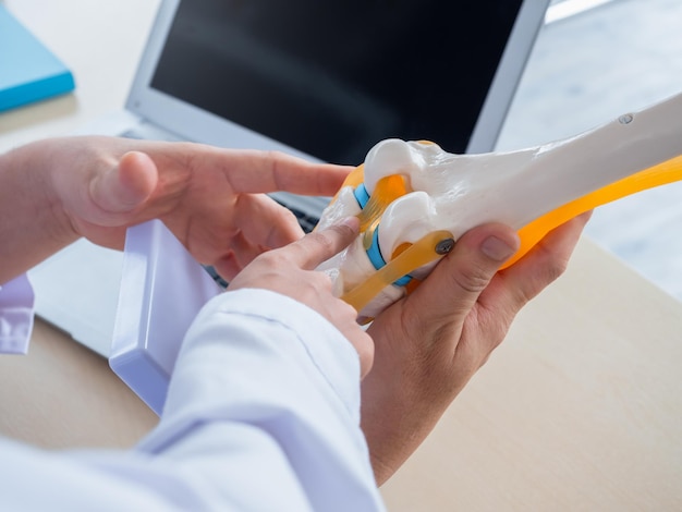 The knee ligaments model holding and pointing by doctor's hands counseling by adult male specialist to young female doctor near laptop Two doctors talking and working together in medical office