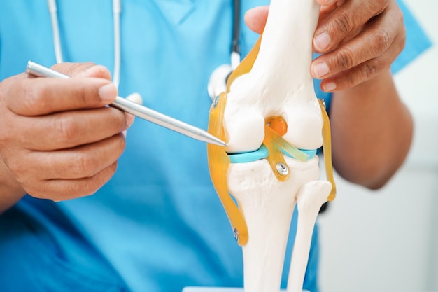 Photo knee osteoarthritis doctor showing model knee joint orthopedic