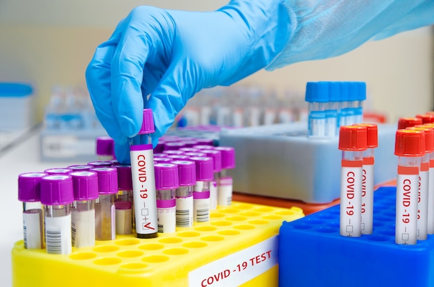 Laboratory Coronavirus Test.