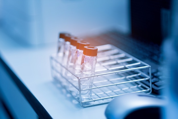 Laboratory pipette with orange light