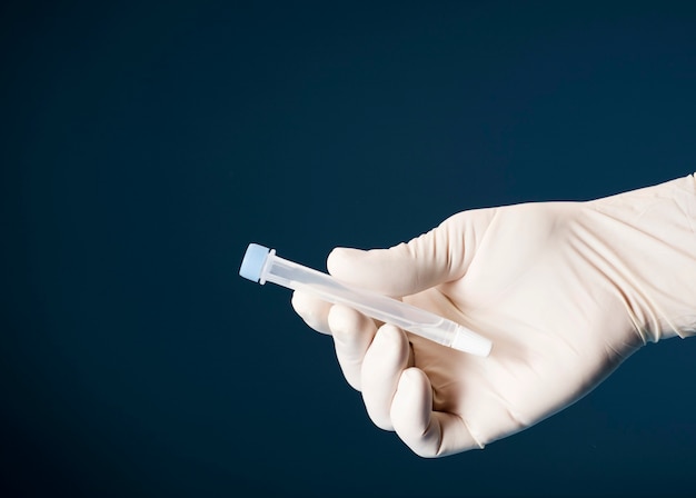 Laboratory scientist with vial and swab indoors performing a rapid diagnostic test, for antibodies, detecting the presence of viral proteins (antigens) expressed by coronavirus disease COVID-19.