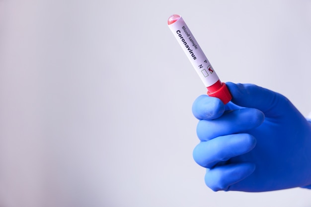 Laboratory technician hand holding blood test tube