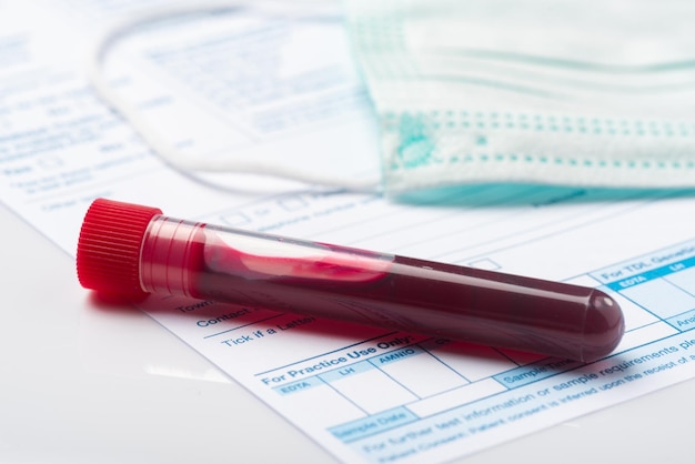 Laboratory Testing Patient's Blood Samples for Presence of Coronavirus COVID19 Test Tube Containing a Blood Sample on Doctor Table