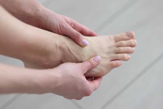 Lady massages painful foot joints with hands in light room woman deals with tiredness of leg in