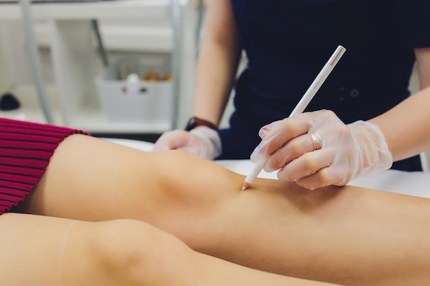 Laser hair removal on ladies legs Intentional shallow depth of field