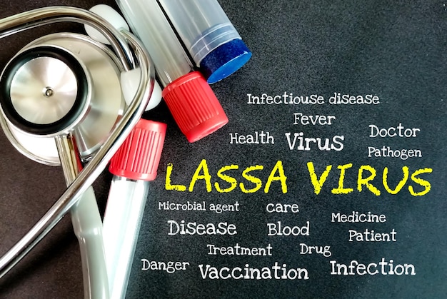 LASSA VIRUS term on blackboard