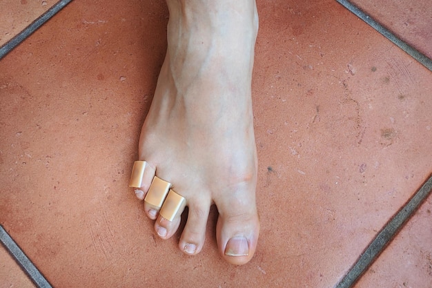 legs with a plasters to callus on toes. Foot skin care and prevention of corns, calluses. First aid