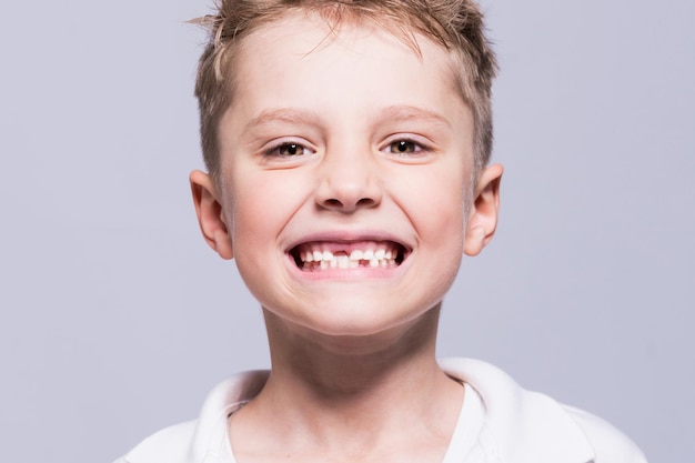 A little boy demonstrates the absence of teeth on a mesh background