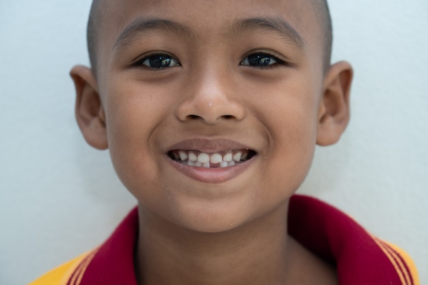 Little boy smiling with Broken teeth