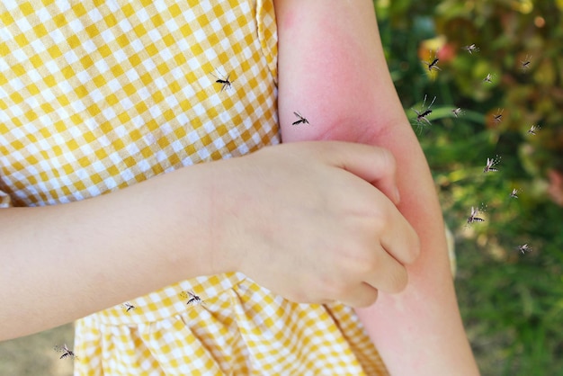 Little girl has skin rash allergy and itchy on her arm from mosquito bite