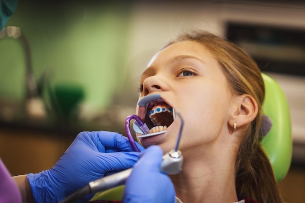 The little girl is at the dentist. She sits in the dentist's chair and the dentist sets braces on her teeth putting indirect bonding.