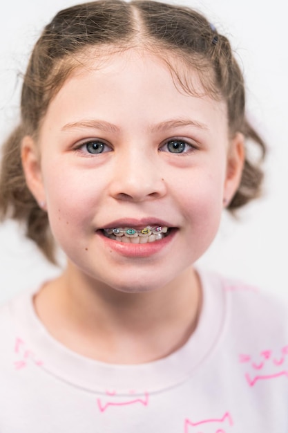 Little girl with rainbow braces