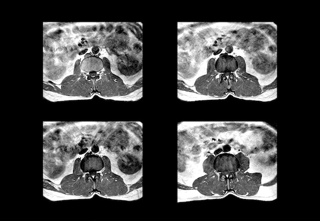 Lower spine ct scan and MRI professional images