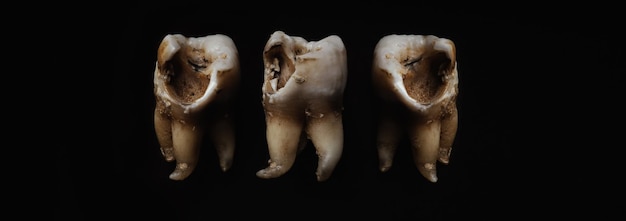 Macro shot of a decayed teeth till root after extraction of dentist