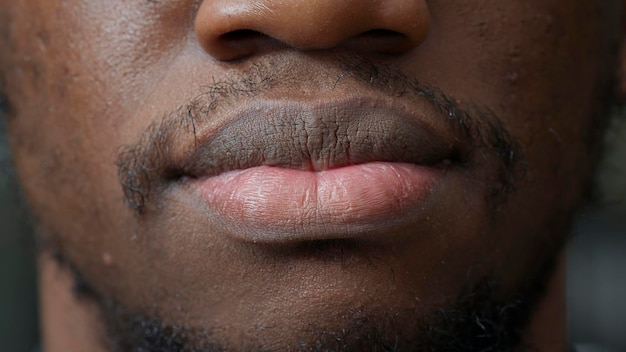 Macro shot of young man smiling in front of camera, having short haired beard and white teeth. Authentic person showing candid smile, with natural healthy skin and facial clean trim. Close up.