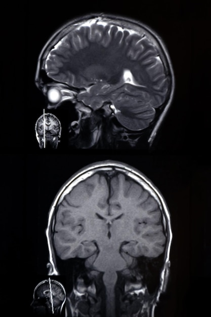 Macrophoto of computer tomography with the brain Medical scientific and educational MRI of the brain