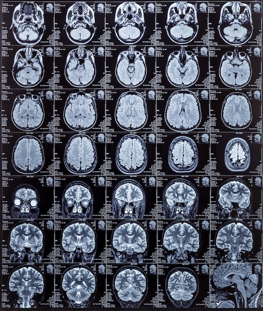 Magnetic resonance imaging