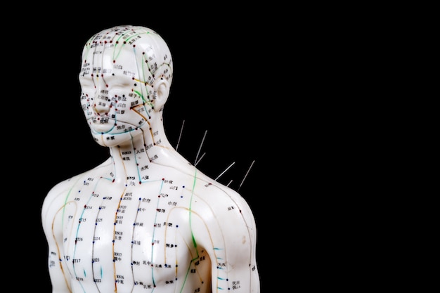 Male acupuncture model with needles 