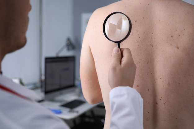 Photo male doctor look at magnifying glass on patient skin