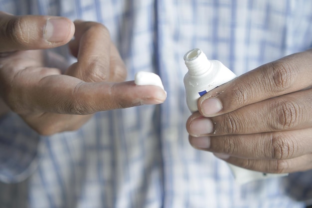 Man applying antibiotic cream close up