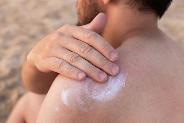 Man applying sunscreen cream on shoulders on beach holiday SPF sunblock protection