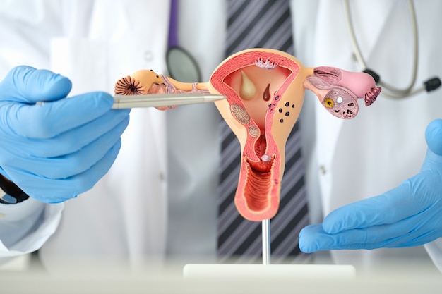 Man gynecologist showing female diseases with pen on plastic artificial model of uterus and ovaries ...