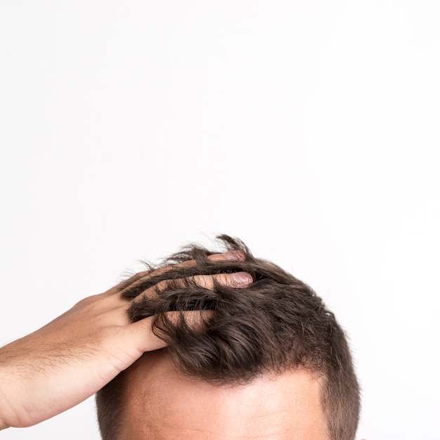 Man having hair fall problem standing against white background