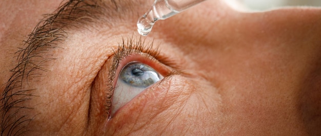 A man moistens his eyes before installing contact lenses drops in the eyes from irritation redness