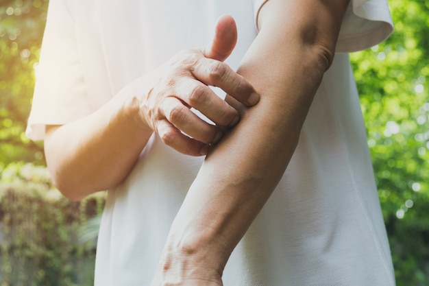 Photo man scratch itch with hand. man scratching his arm healthcare concept.