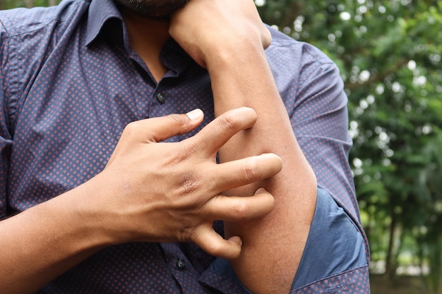 Man suffering from itching skin close up