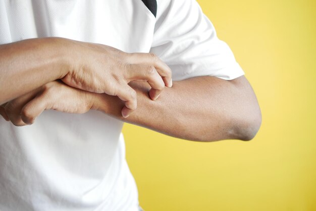 Man suffering from itching skin close up