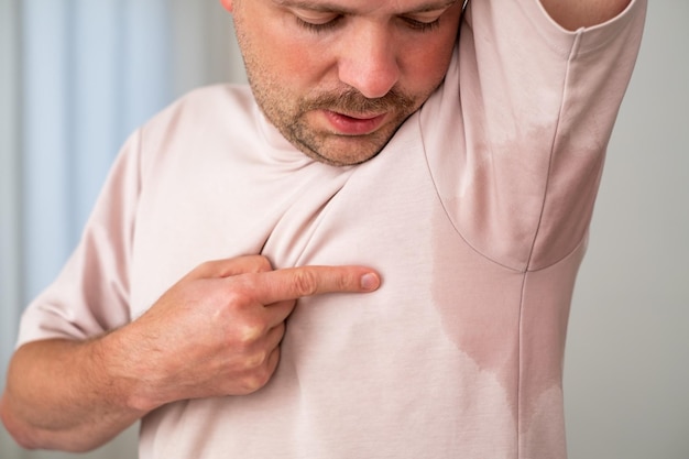 Man with hyperhidrosis sweating very badly under armpit