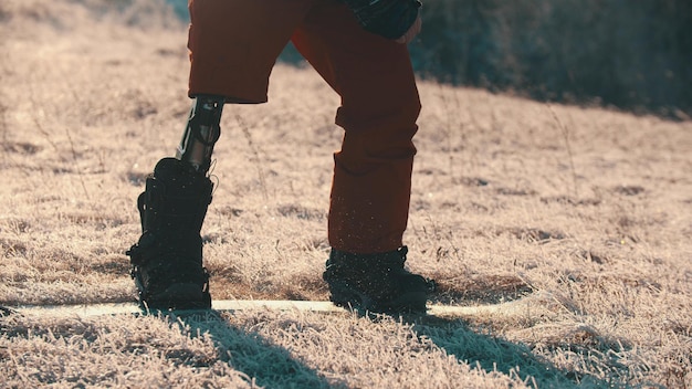 A man with prosthetic leg standing on the board  injured leg