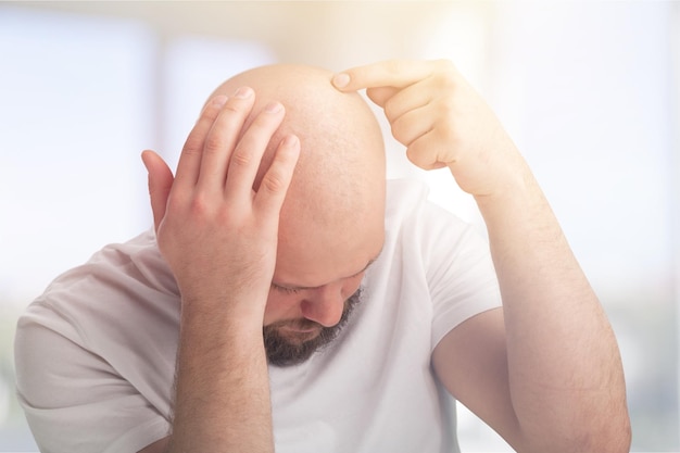 Mature man with problem hair loss