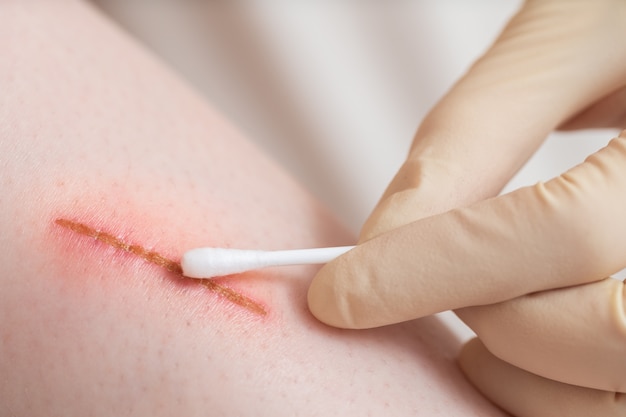 Medical assistant changes the dressing of a wound at the emergency room