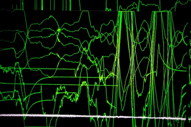 Medical background cardiogram on the monitor