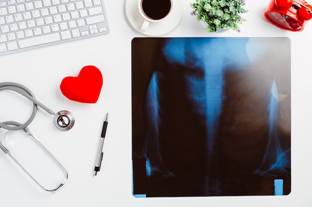 Medical desk with stethoscope,heart,pen,laptop,mouse and x-ray film on white desk.Top view