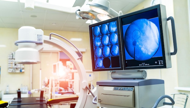 Medical devices for ultrasound examination on a background of the screen Modern operating theatre Closeup