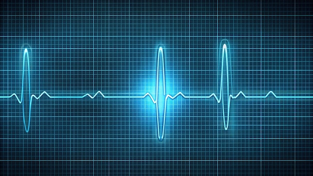 Photo medical illustration of atrial fibrillation conduction abnormality with ecg