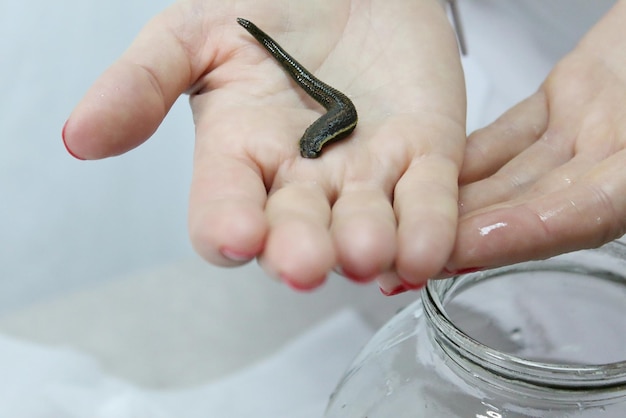 Medical leech on the doctor's gloved hand