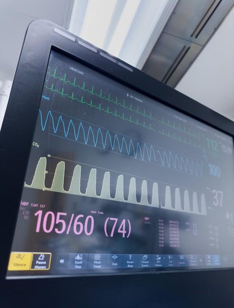 Medical monitor displays vital signs with graphs and numbers heart rate blood pressure temperatur