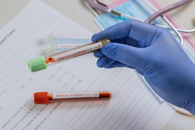 Medical professionals in the laboratory with tube containing blood samples for new version Omicron Covid-19 Coronavirus