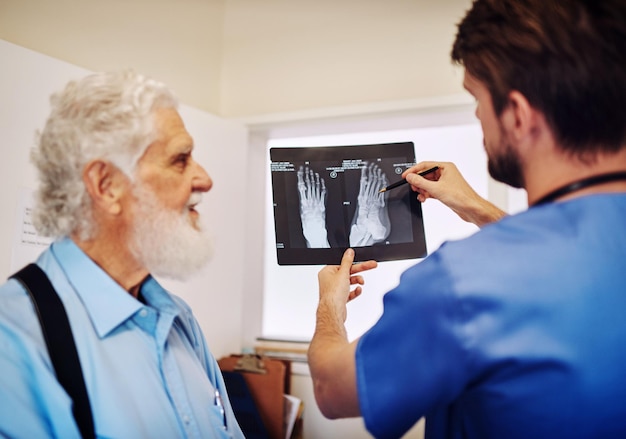 Photo medical senior man and nurse with xray in healthcare consultation for diagnosis results of foot injury radiology patient and doctor with scan for health review fracture and analysis in clinic