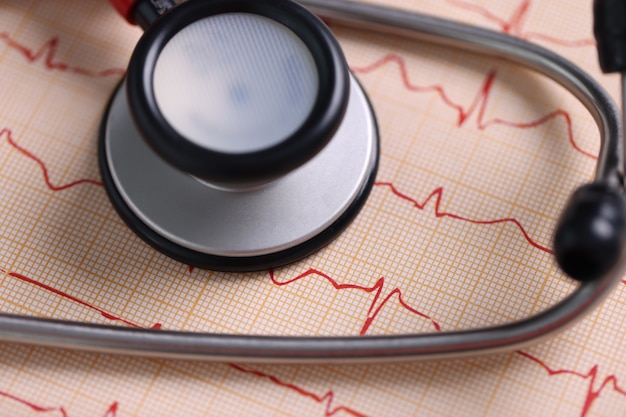 Medical stethoscope and printed cardiogram on table. Cardiologist services concept